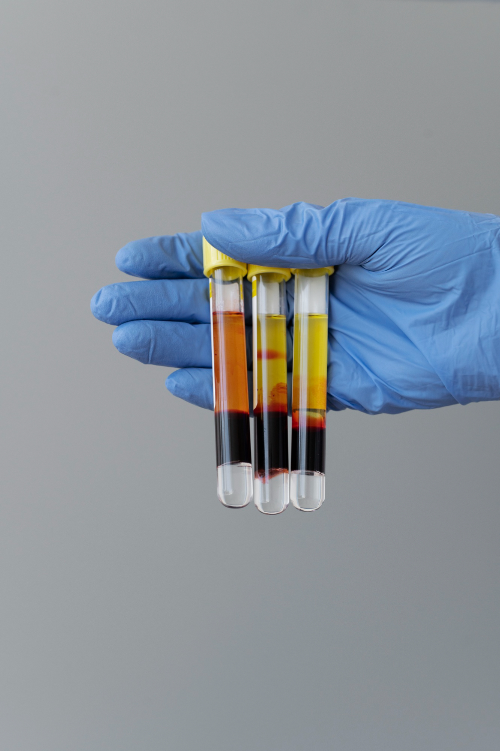 Cosmetic PRP Training
